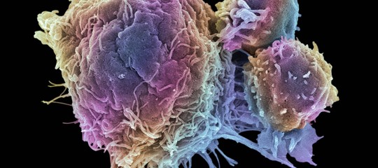 cancro studio italiano scopre meccanismo che blocca la crescita